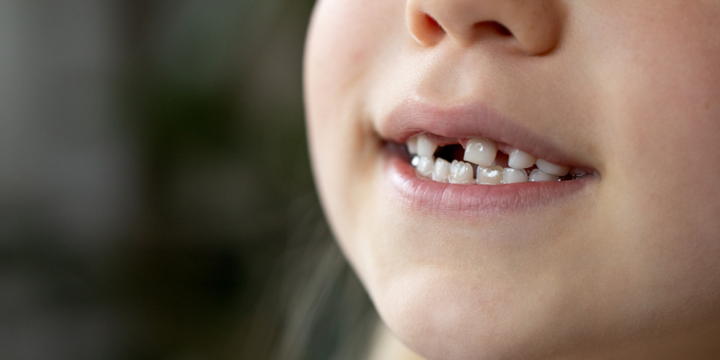 Kids Dentist: Growth Monitoring and Dental Development