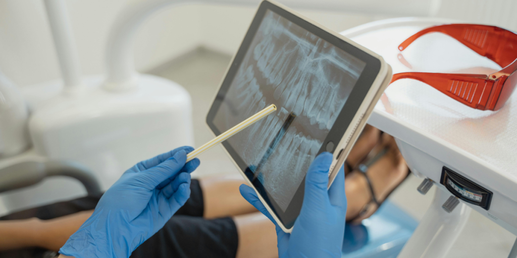 Kids Dentist X-Ray Guide: Types and Why They Matter